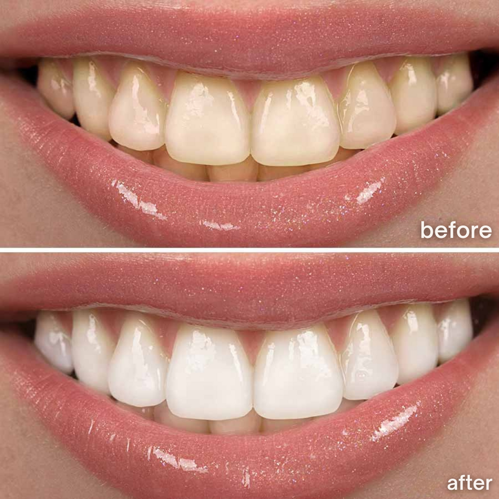 Sonic White - sonic toothbrush for radiant white teeth